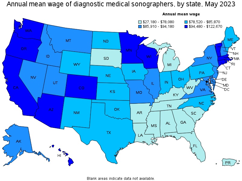 ultrasound tech salary